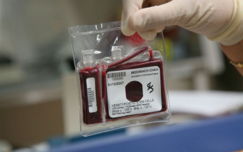 ذخیره بیش از ۲ هزار نمونه در بانک خون بند ناف البرز